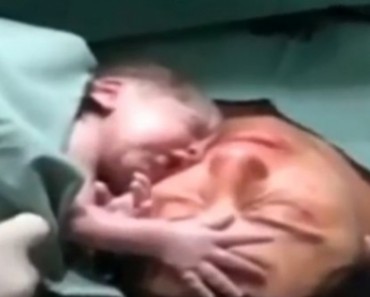 This Moment Is Breathtaking! See What This Baby Did A Few Seconds After Birth! Even Doctors Were Moved!