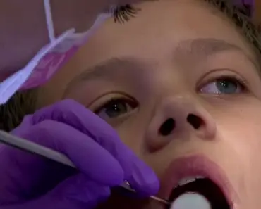 Shark Boy’: British Schoolboy Develops Second Set Of Teeth!
