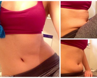 Fitness Fan Posts ‘Real’ Shots of Her Stomach. Why Millions of People Shared the Images