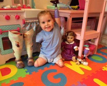 Little Girl Who Lost Her Limbs To Rare Disease Gets An Adorable Mini-Me Doll
